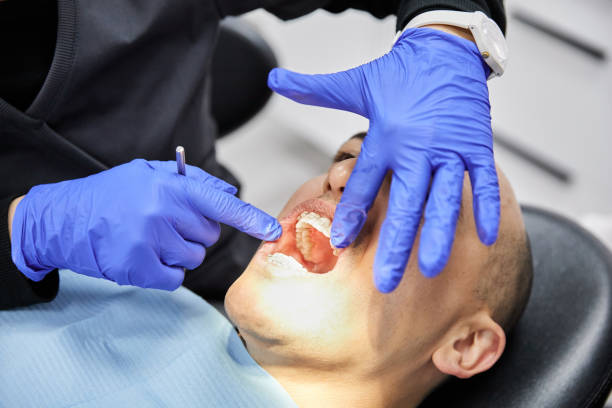 Best Dentist for Tooth Abscess  in Miami Beach, FL